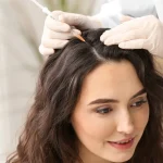 مقایسه تخصصی مزوتراپی و فیلر مو؛ کدام روش برای تقویت موها بهتر است؟