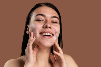 راهنمای انتخاب بهترین شوینده برای پوست مستعد آکنه و روتین مراقبتی ایده‌آل