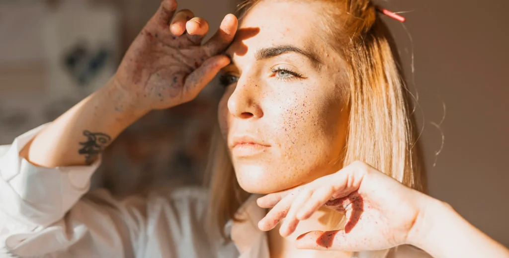 درمالیدی - درمان لکهای پوستی تابستان: راههای موثر برای درمان و پیشگیری درمان لکهای پوستی تابستان: راههای موثر برای درمان و پیشگیری