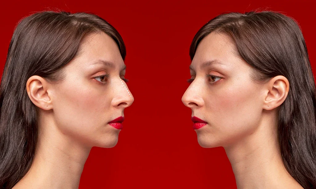 قوز بینی شد نماد جذابیت 2026! پایان امپراتوری بینی‌های سربالا و آغاز عصر چهره‌های نچرال