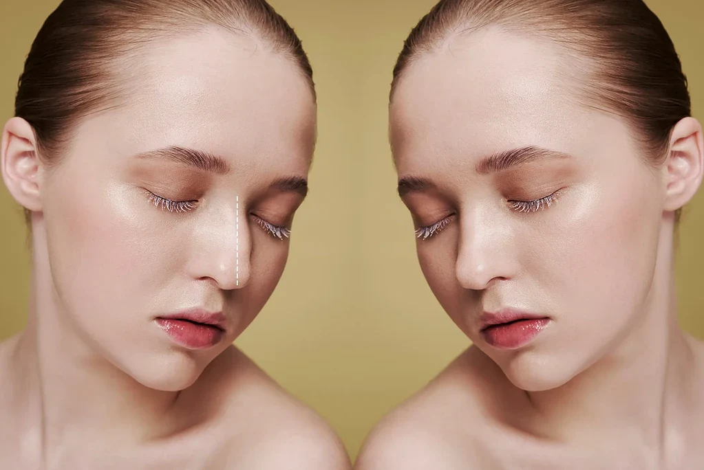 قوز بینی شد نماد جذابیت 2026! پایان امپراتوری بینی‌های سربالا و آغاز عصر چهره‌های نچرال