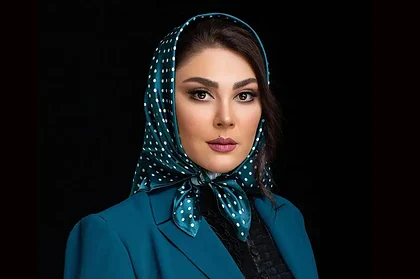 چهره تازه لاله اسکندری ترکاند! تغییر بزرگ بازیگر محبوب ایرانی بعد از عمل زیبایی