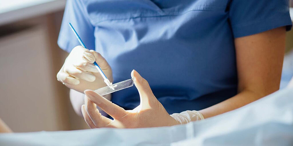 نجات با یک تست پاپ اسمیر؛ غربالگری سرطان دهانه رحم و ارتباط آن با HPV