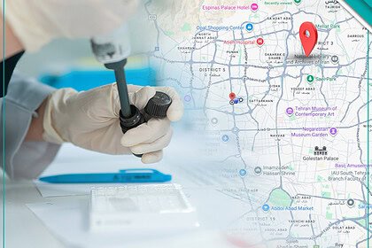 بهترین آزمایشگاه هورمونی در شمال تهران