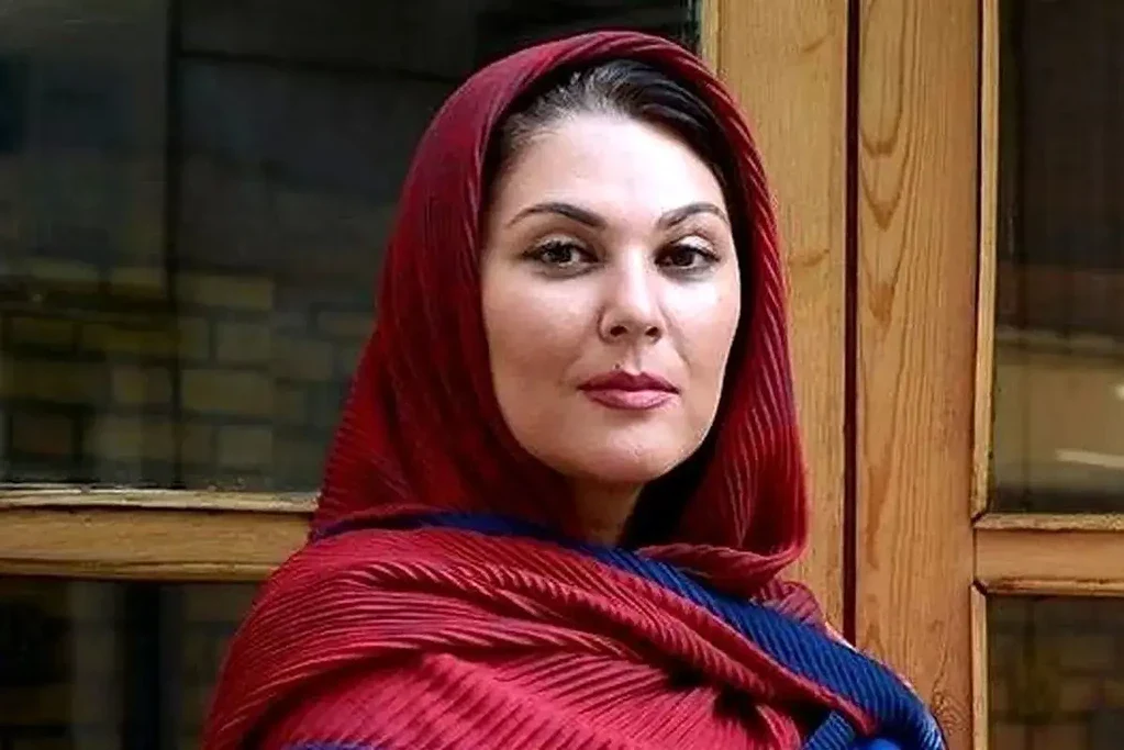 درمالیدی - چهره تازه لاله اسکندری ترکاند! تغییر بزرگ بازیگر محبوب ایرانی بعد از عمل زیبایی چهره تازه لاله اسکندری ترکاند! تغییر بزرگ بازیگر محبوب ایرانی بعد از عمل زیبایی