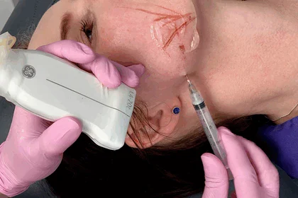 فیلر اسکالپترا؛ معجزه کلاژن‌ساز و راز جوانی ماندگار هالیوودی‌ها