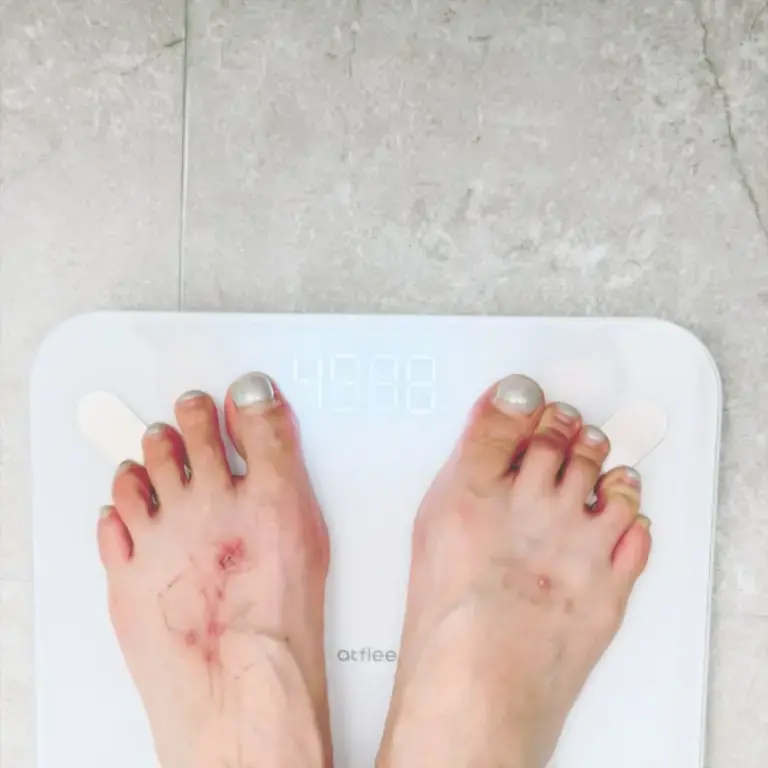 درمالیدی - سقوط هولناک هیونا ملکه کیپاپ روی استیج؛ افشاگری تکاندهنده هیونا از رژیم مرگبار و بیماری پنهان سقوط هولناک هیونا ملکه کیپاپ روی استیج؛ افشاگری تکاندهنده هیونا از رژیم مرگبار و بیماری پنهان