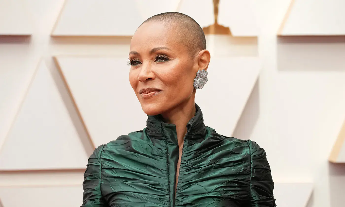 تاثیر ریزش موی زنان بر سلامت روان، خواب و موفقیت / جیدا پینکت اسمیت