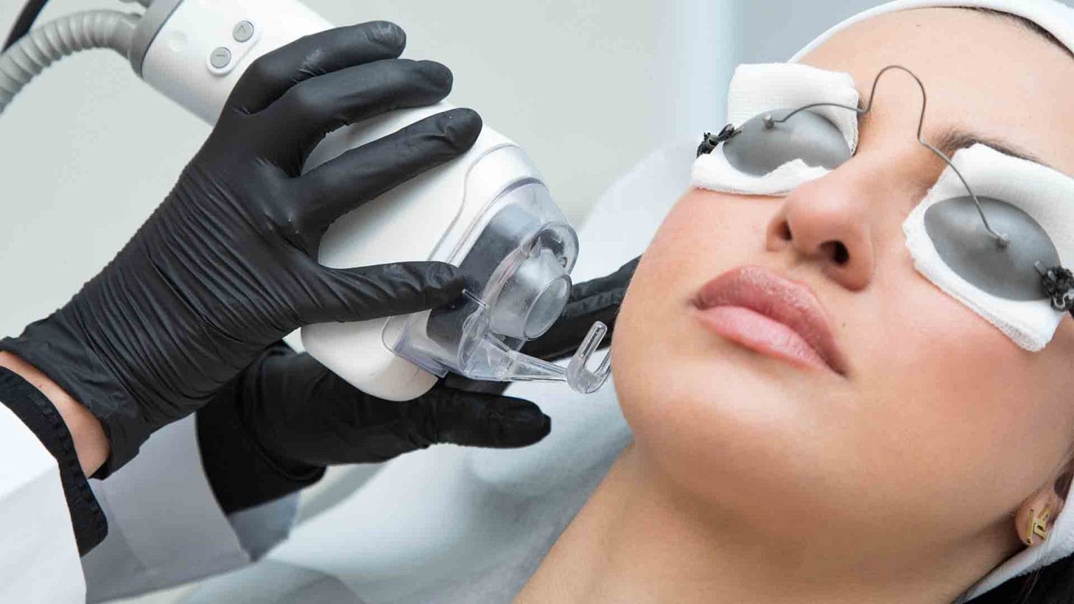لیزر فرکشنال CO₂: معجزه‌گر زیبایی و سلامت پوست – راهنمای جامع بایدها و نبایدها