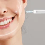 بوتاکس خط خنده: راهنمای جامع برای بازگرداندن جوانی و زیبایی چهره