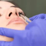 تزریق بوتاکس به بینی: راهکاری کم‌هزینه و مؤثر برای زیبایی و تقارن صورت