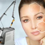 لیزر کیو سوئیچ برای جوانسازی پوست، درمان اسکار و پاک کردن تاتو