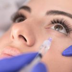 بوتاکس ژلی رول: آیا بوتاکس زیر چشم برای شما مناسب است؟ 